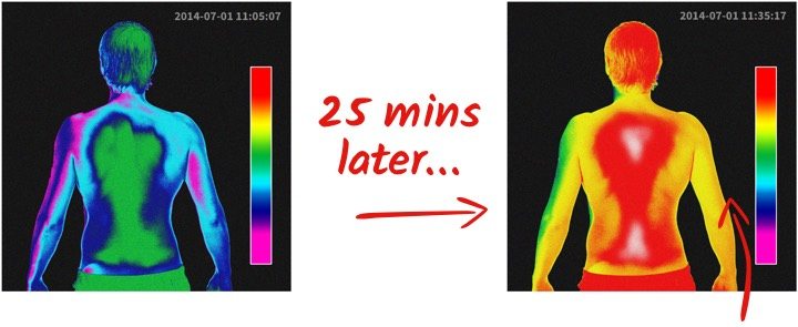 Back pain Heat Map